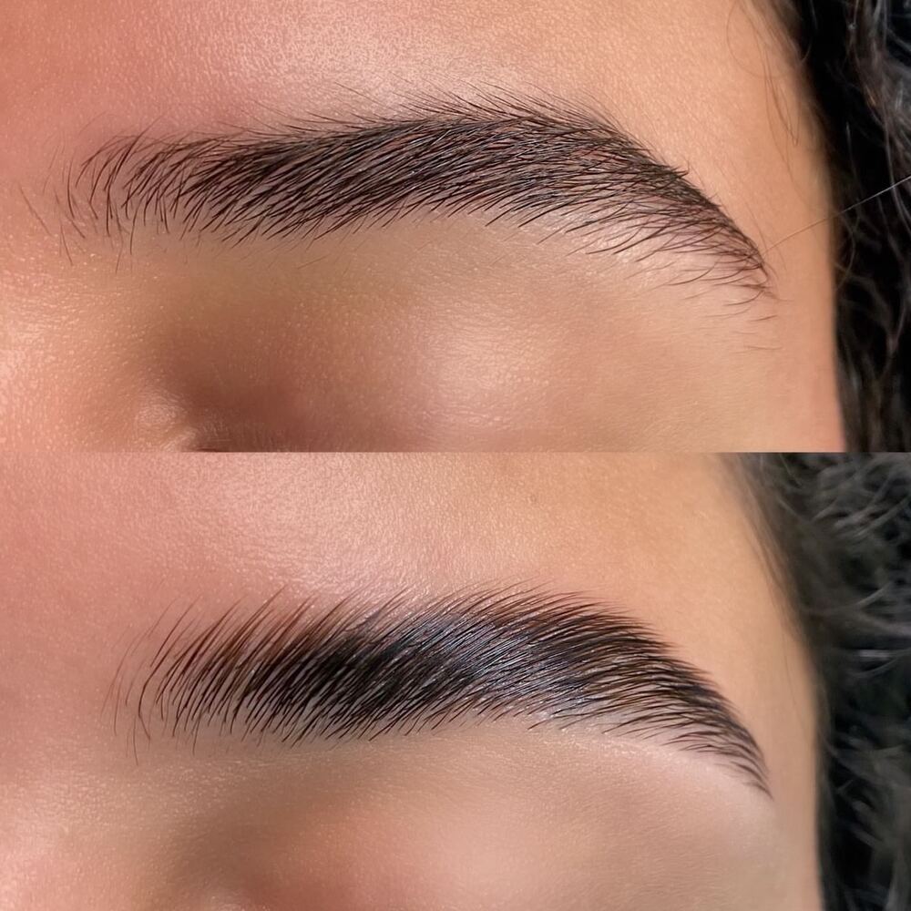 Avant / après Brow Lift